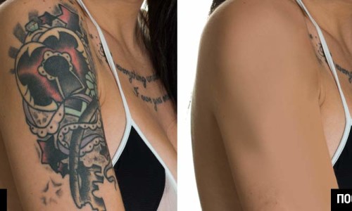 удаление татуировки на фото в фотошопе